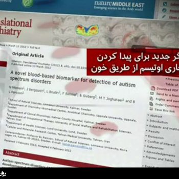 تشخیص زودهنگام اختلال اوتیسم