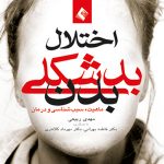 اختلال بدشكلی بدن