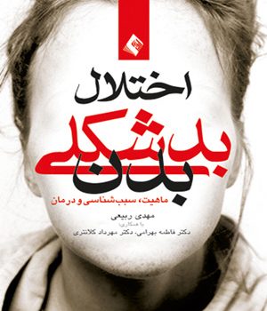 اختلال بدشكلی بدن
